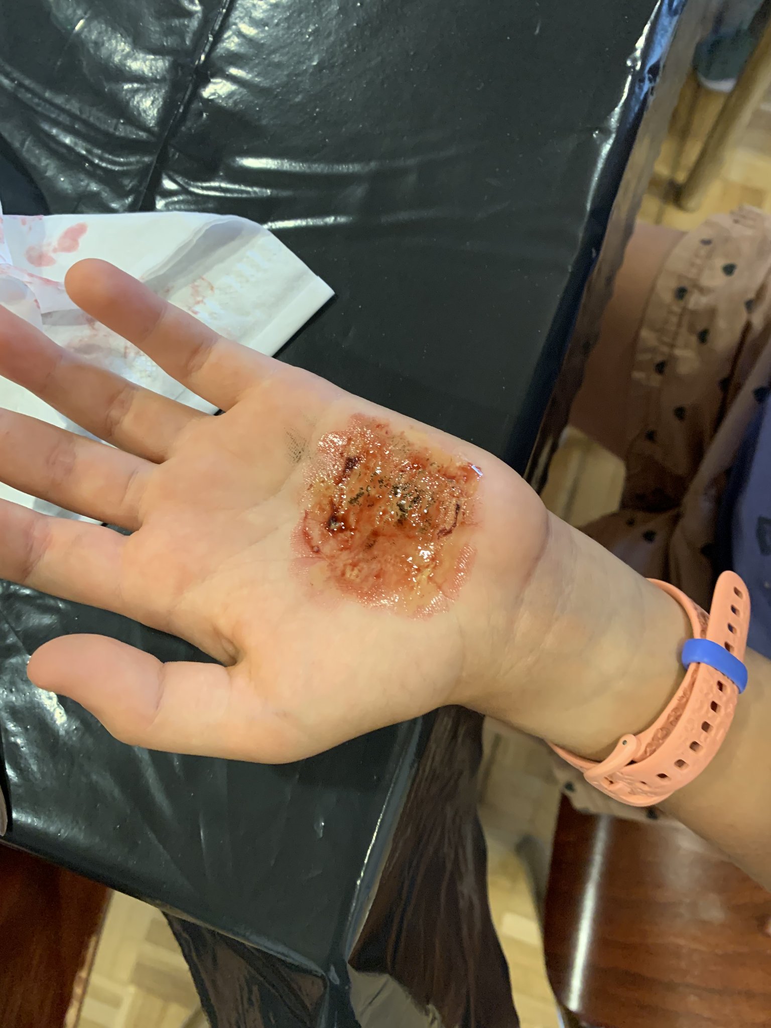 filmreife Verletzung