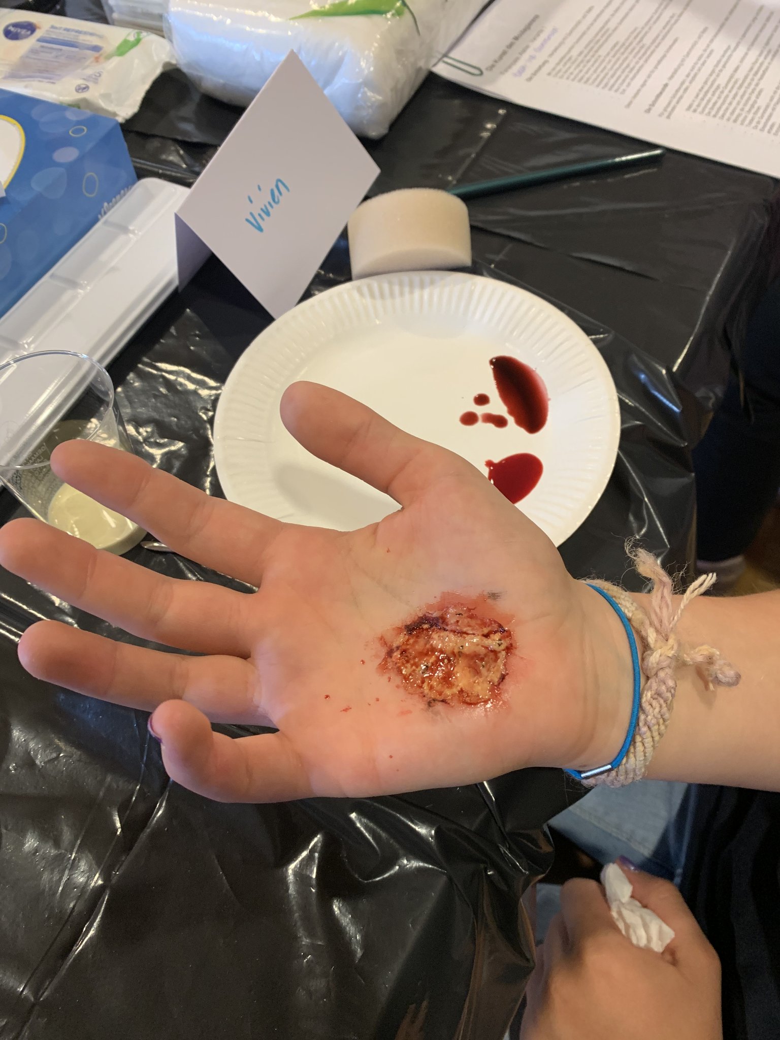 Filmreife Verletzung